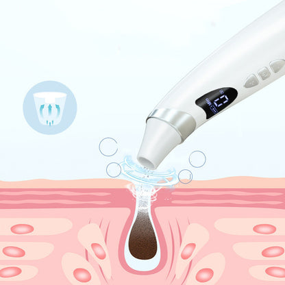 Electric Blackhead Remover & Pore Cleaner for Skin Care